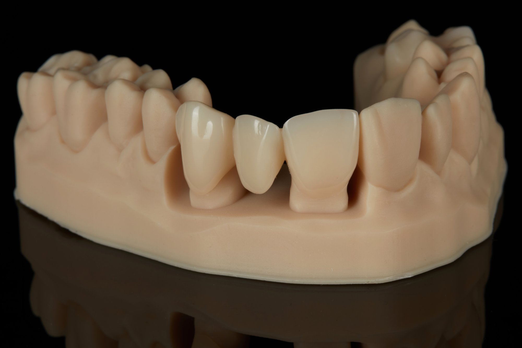 BEGO VarseoSmile TriniQ Resin (Form 4B) - Imagen 3