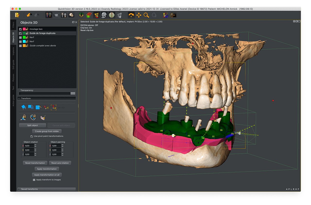 Owandy I-MAX 3D XPRO - Tomógrafo Dental 3D - Imagen 4