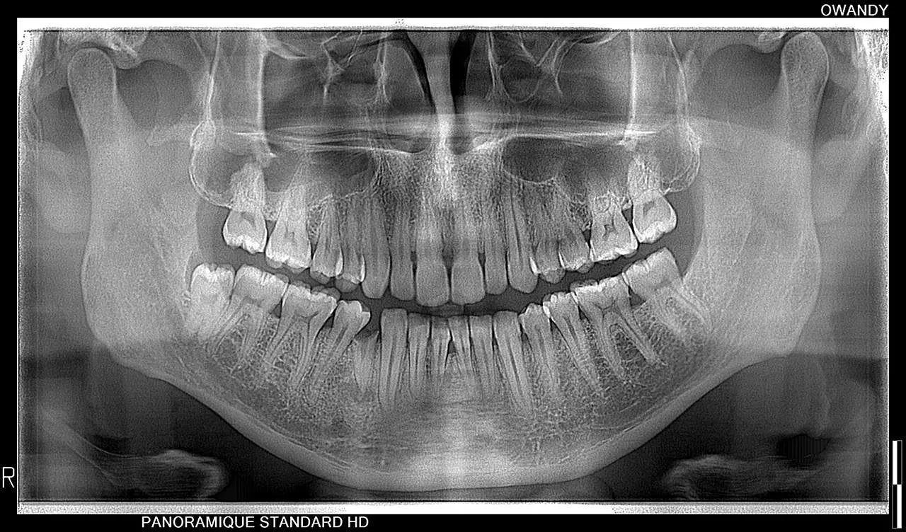 Owandy I-MAX 3D XPRO - Tomógrafo Dental 3D - Imagen 9