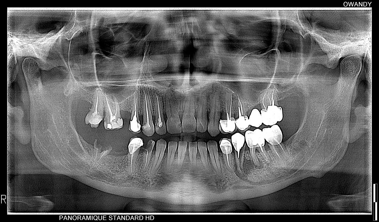 Owandy I-MAX 3D XPRO - Tomógrafo Dental 3D - Imagen 8