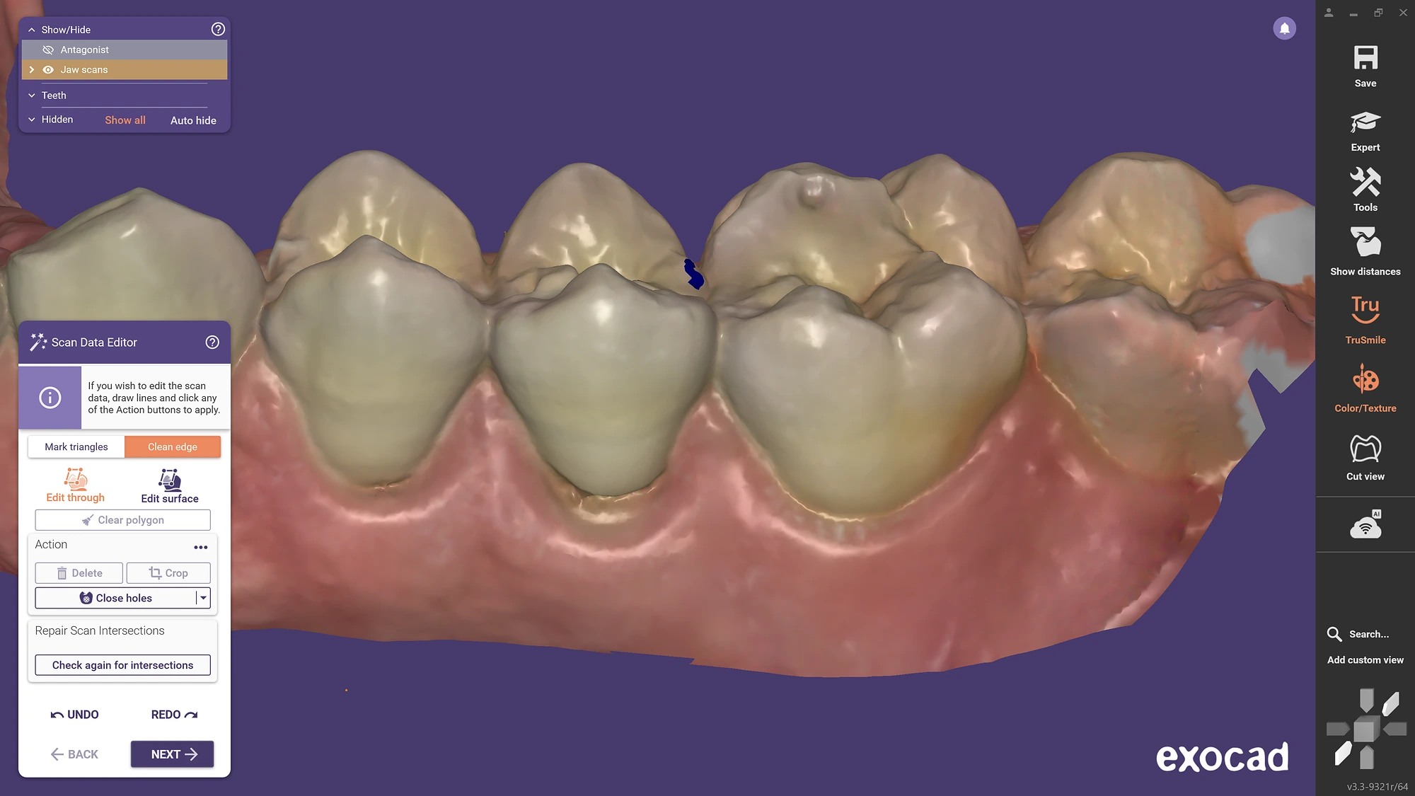 exocad DentalCAD - Imagen 11