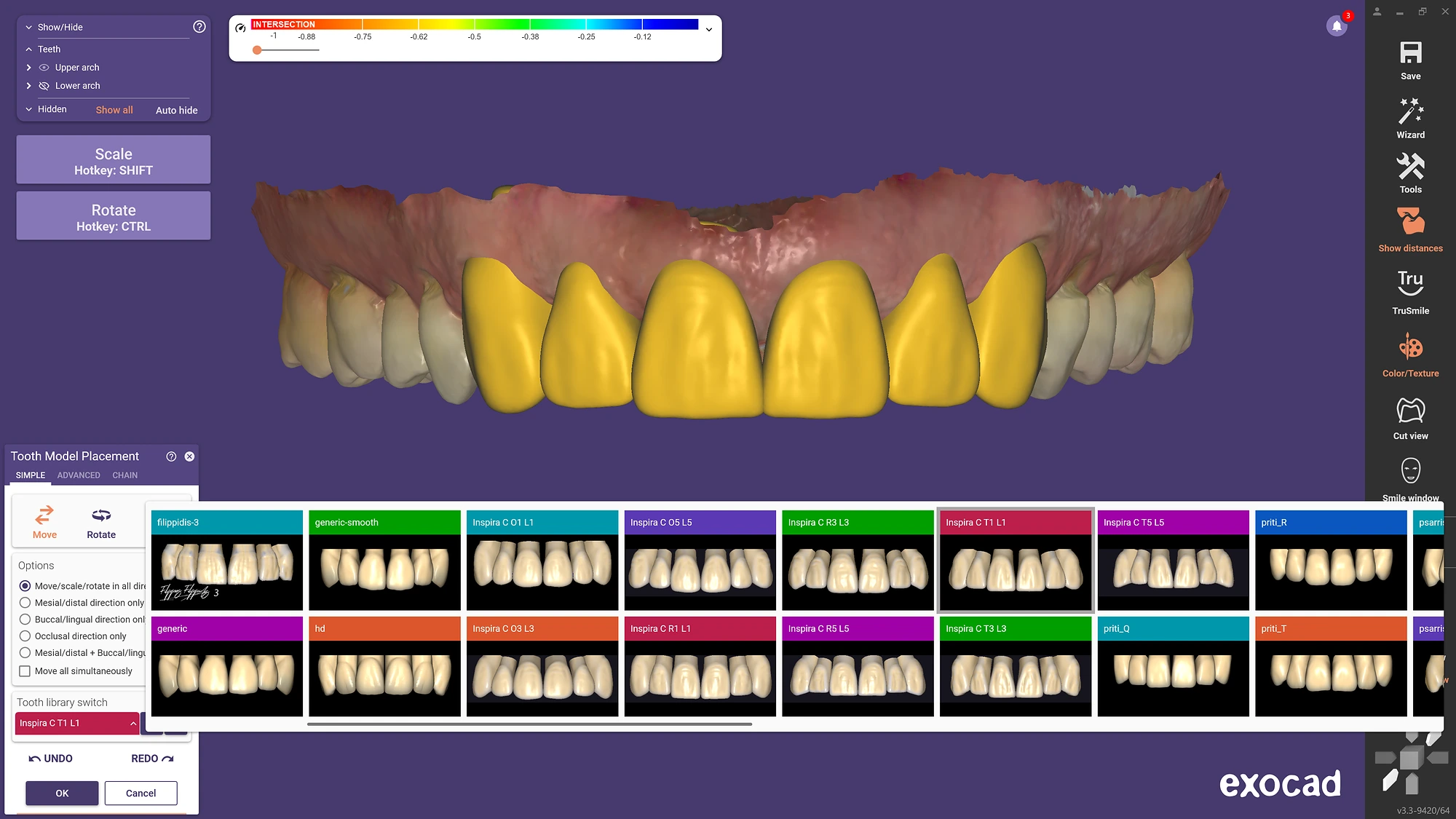 exocad DentalCAD - Imagen 12
